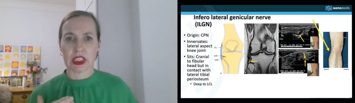 Ultrasound of Nerves of the Lower Leg - Knee to Foot